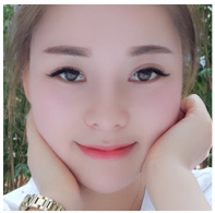 美萊案例袁婷對(duì)比圖后