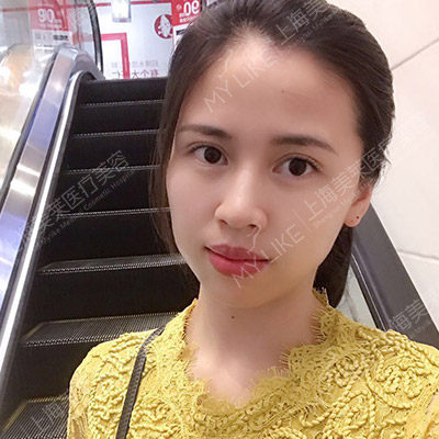 術(shù)后1個月