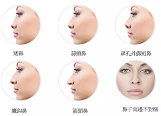 打玻尿酸鼻子會(huì)變寬，是不是真的？