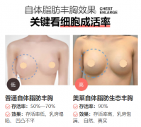 昭通做自體脂肪豐胸，怎么提高脂肪存活率