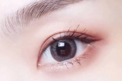 杭州醫(yī)院做眼睛切開(kāi)法雙眼皮需要多少錢(qián)呢