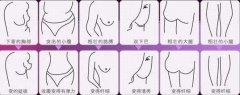 沈陽做抽脂減肥費(fèi)用是多少