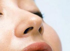 鄭州多少錢(qián)可以做鼻小柱延長(zhǎng)術(shù)呢
