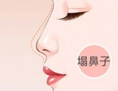 假體隆鼻的有無(wú)后后遺癥？假體隆鼻的材料有無(wú)副作用?