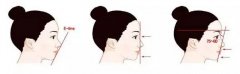 重慶做開(kāi)眼角之后不能吃哪些東西？
