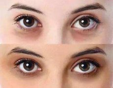 愛(ài)美女生如何消除黑眼圈？