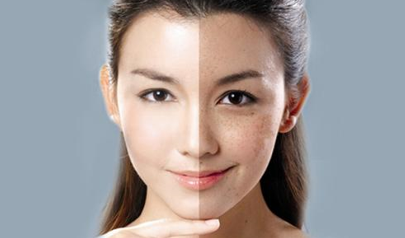怎樣縮小毛孔？