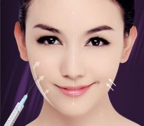 瘦臉針效果能維持多久？