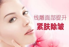 做提升優(yōu)勢有那些呢？