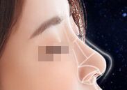 重慶整鼻子失敗了還可以修復(fù)嗎？