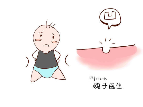 深圳乳頭凹陷整形的方式有哪些？