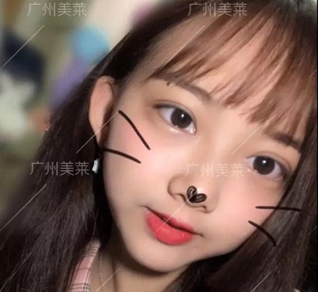 這款韓式明眸大眼術(shù)，3.8女神節(jié)有勁爆特惠價(jià)！