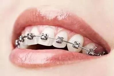 牙齒不好看？告訴你一個(gè)2小時(shí)變美的方法~