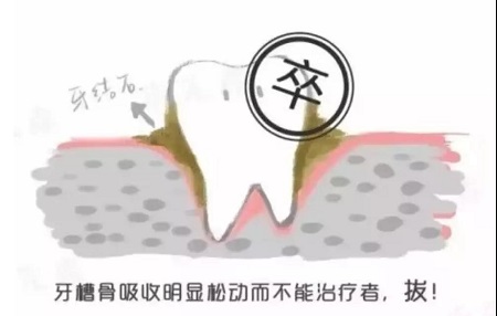 牙齒矯正可以用一輩子嗎？