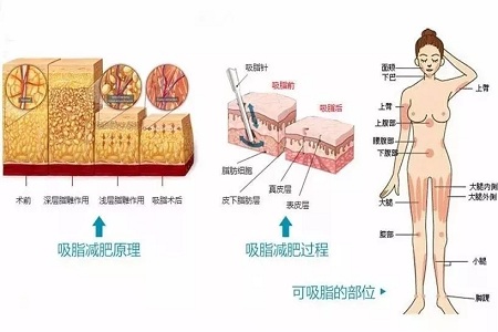 四月不吸脂，五、六、七月徒傷悲......