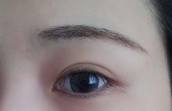 雙眼皮手術要多少錢？