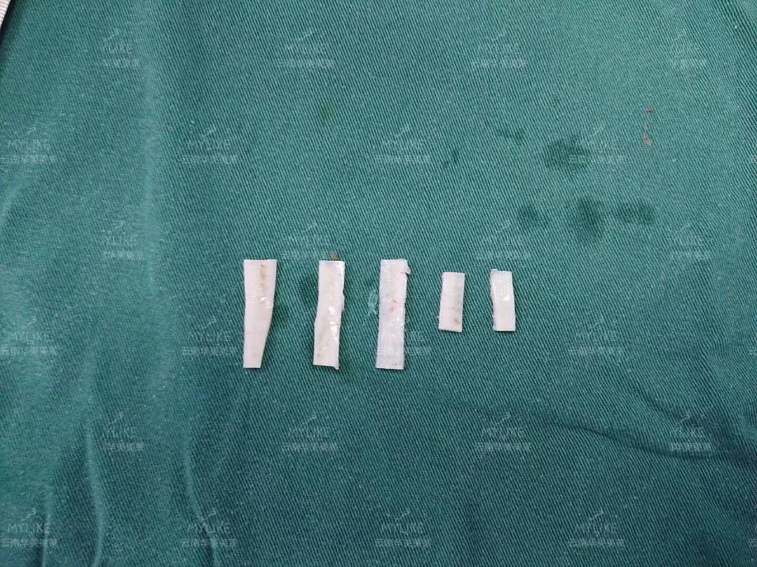 美萊綜合塑鼻