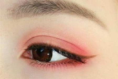 雙眼皮+開眼角為什么是較佳拍檔，一分鐘帶你看懂！