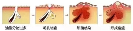 如何在炎熱的夏天，做清爽白凈的小姐姐？