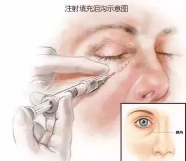 顯老淚溝，你還要任其放肆嗎？