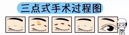 美眼張誠坐診美萊，淺談為什么你的眼睛不夠美？