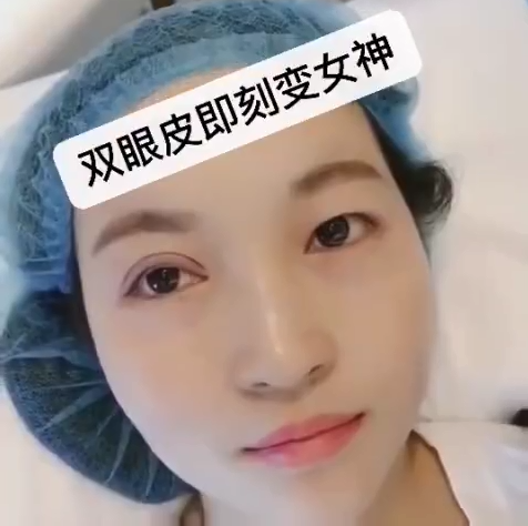 天津美萊不做雙眼皮，你永遠(yuǎn)不知道自己會(huì)有多美