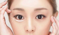 深圳美萊祛除眼袋的更好辦法是什么？