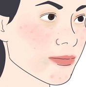 美萊醫(yī)生介紹讓你「不花冤枉錢」的嫩膚攻略，把錢花在刀刃上