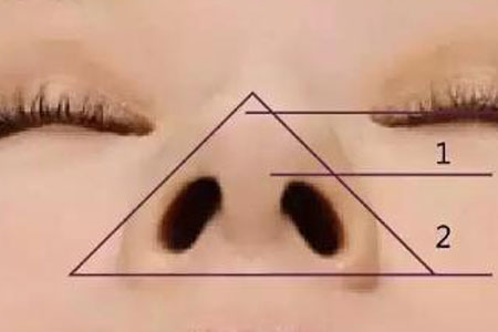 鼻頭大做手術(shù)縮小需要多少錢，手術(shù)安全嗎？