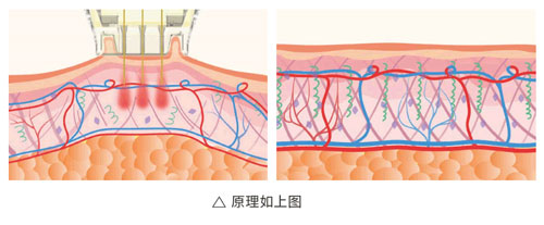 超光子+水光，“撐起”皮膚彈、潤(rùn)、緊